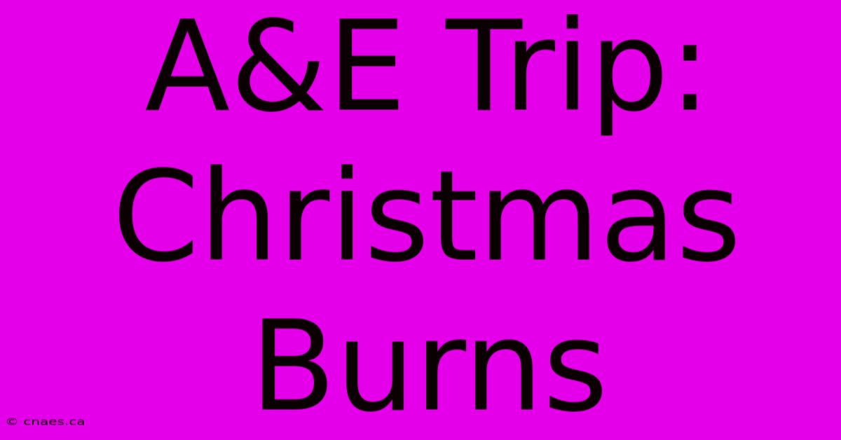 A&E Trip: Christmas Burns