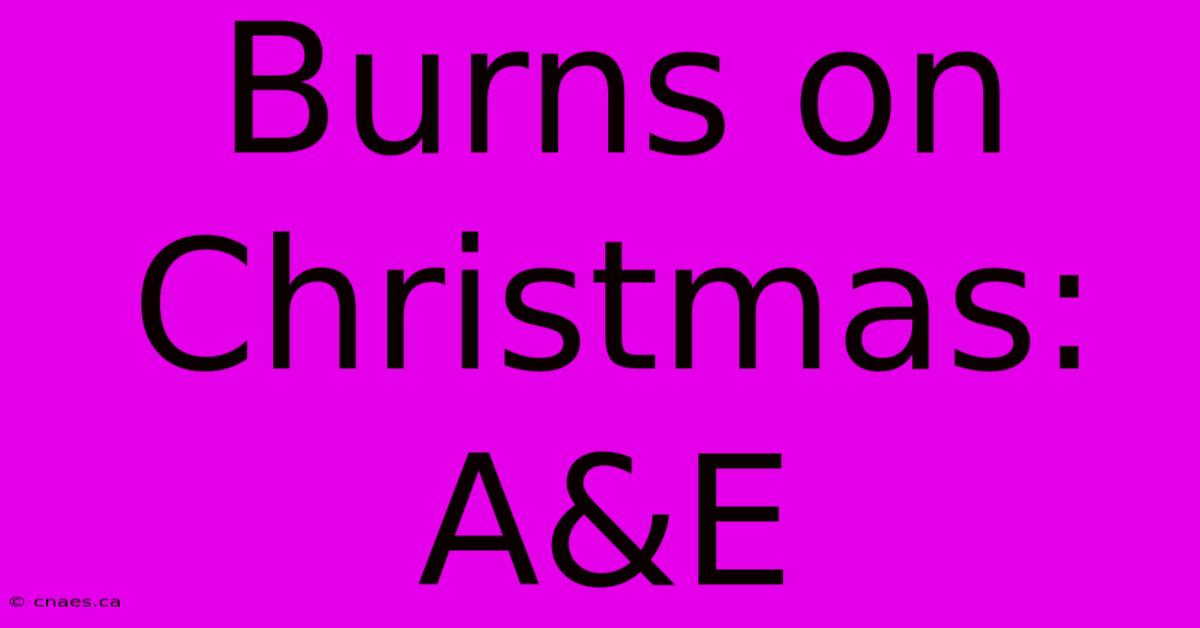 Burns On Christmas: A&E