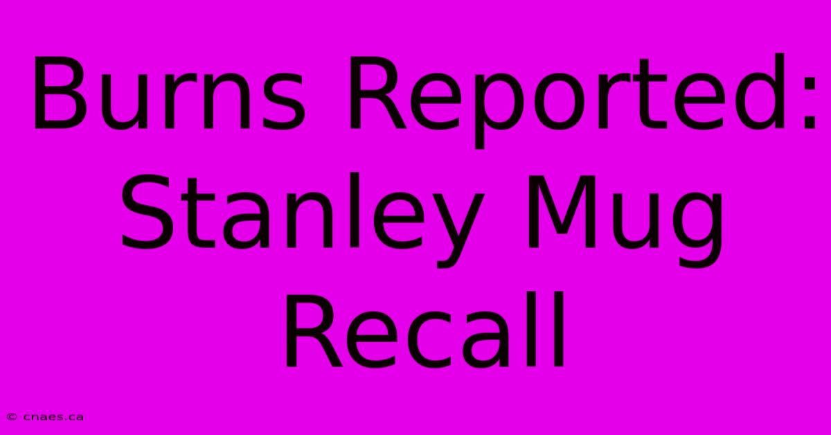 Burns Reported: Stanley Mug Recall