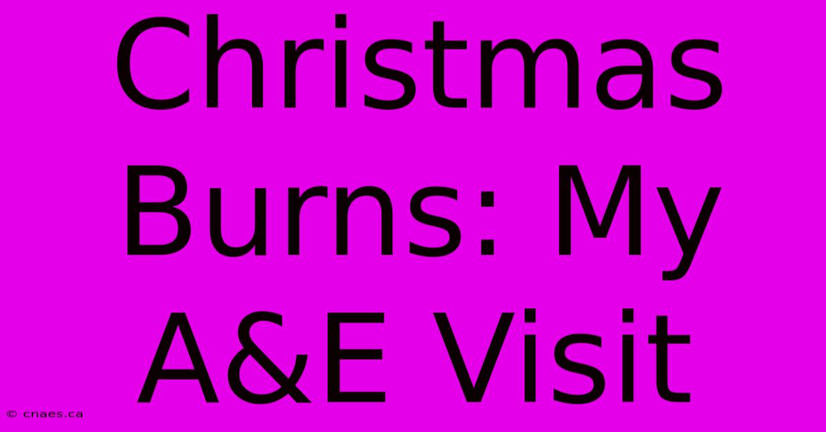 Christmas Burns: My A&E Visit