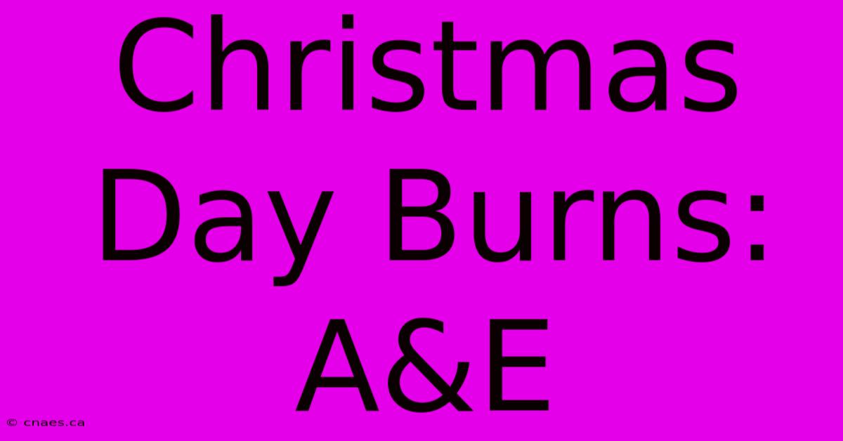 Christmas Day Burns: A&E