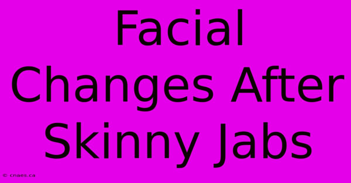 Facial Changes After Skinny Jabs