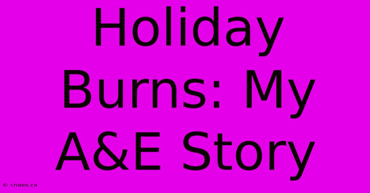 Holiday Burns: My A&E Story