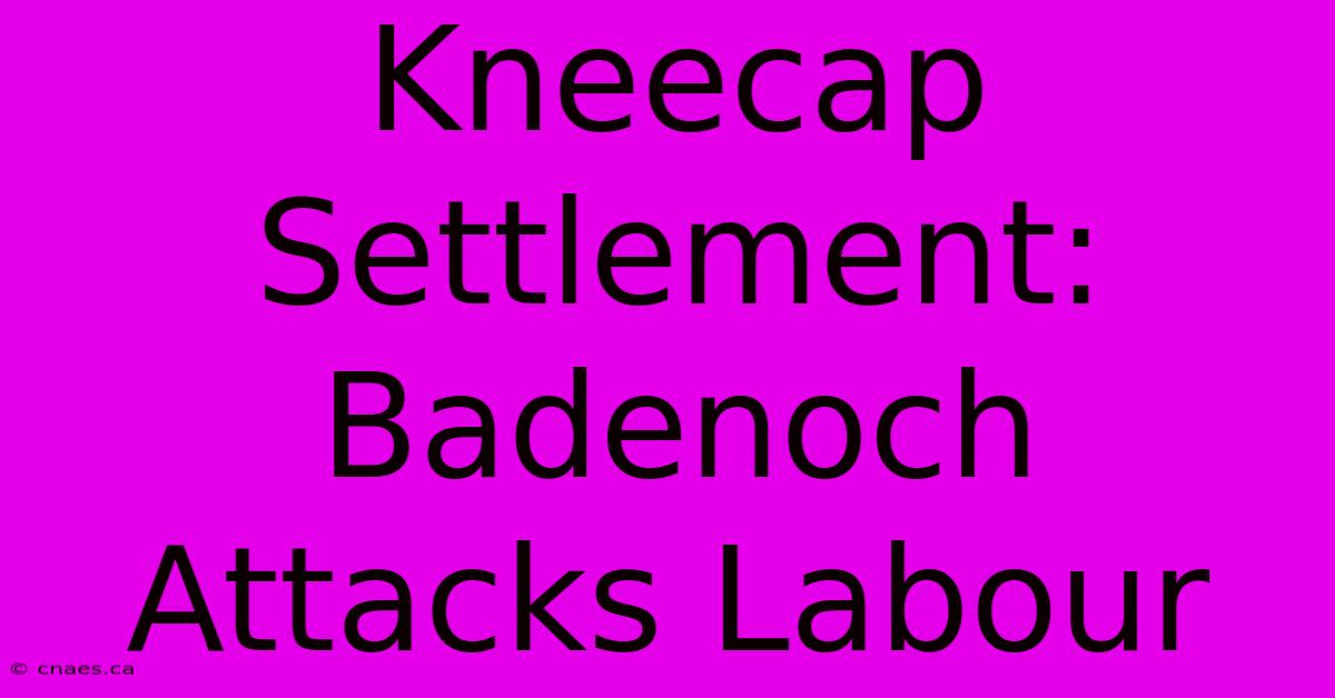 Kneecap Settlement: Badenoch Attacks Labour