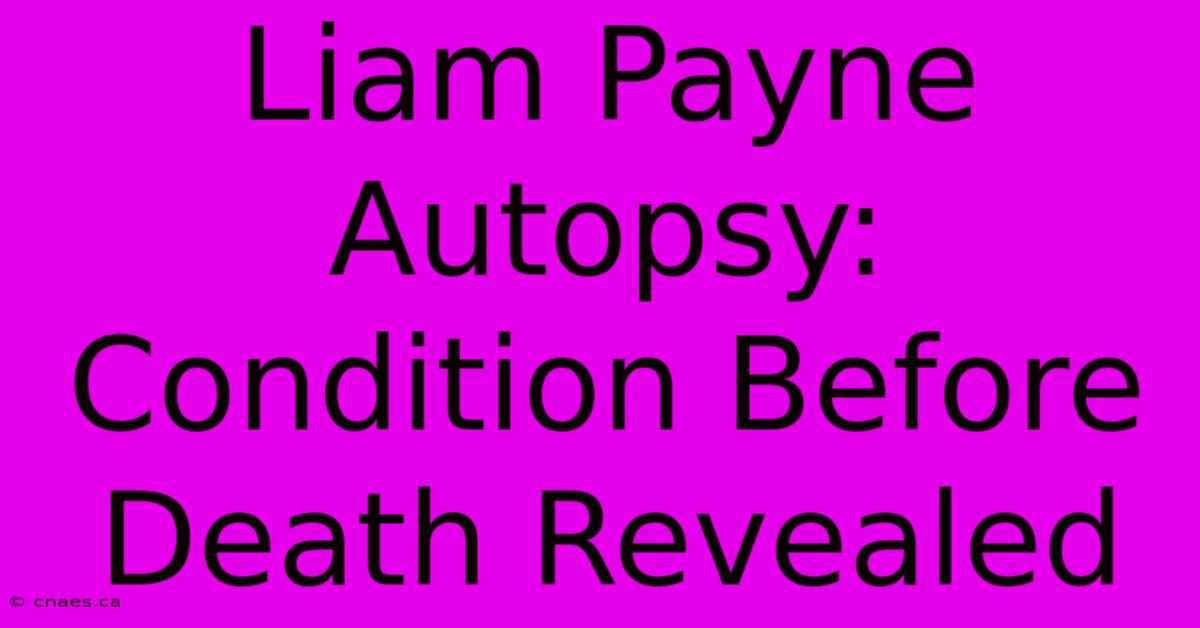 Liam Payne Autopsy: Condition Before Death Revealed