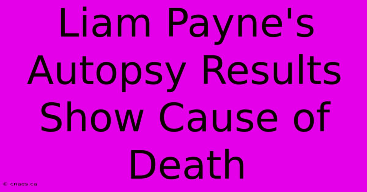 Liam Payne's Autopsy Results Show Cause Of Death