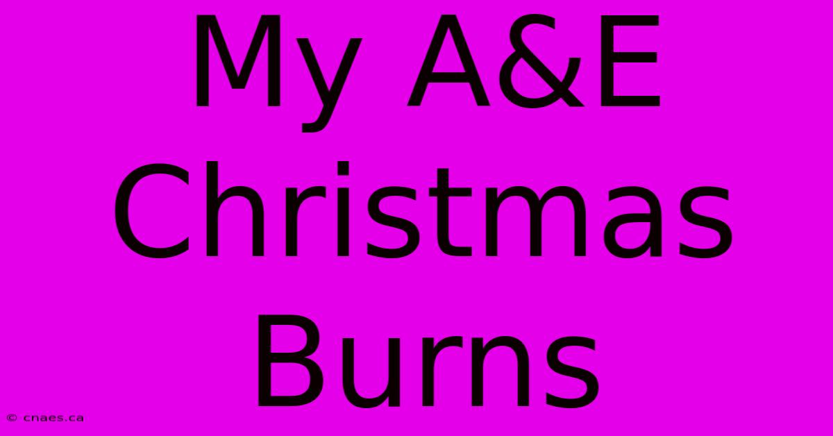 My A&E Christmas Burns