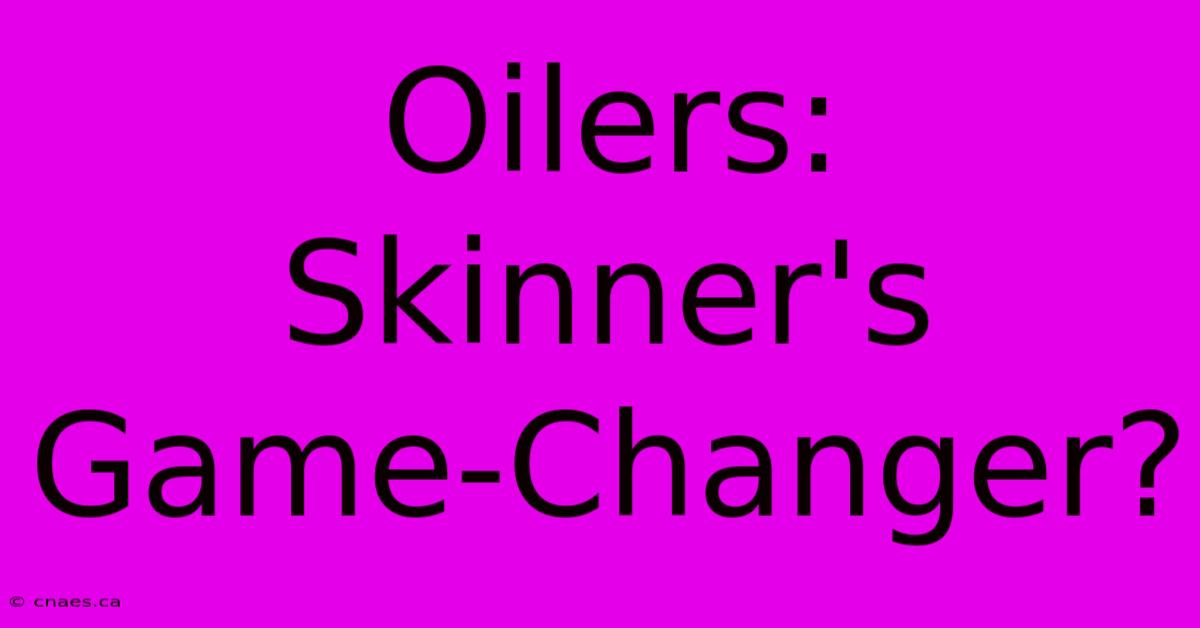 Oilers: Skinner's Game-Changer?