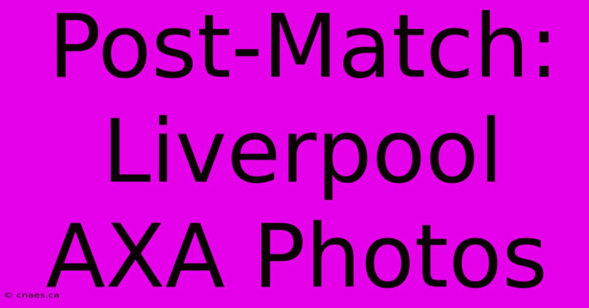 Post-Match: Liverpool AXA Photos