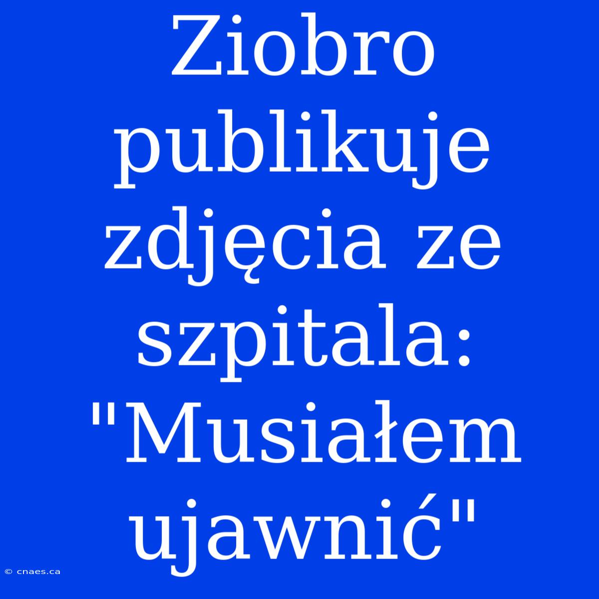 Ziobro Publikuje Zdjęcia Ze Szpitala: 